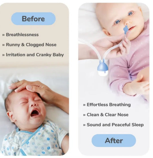 R For Rabbit - Snowy Nasal Cleaner - Blue